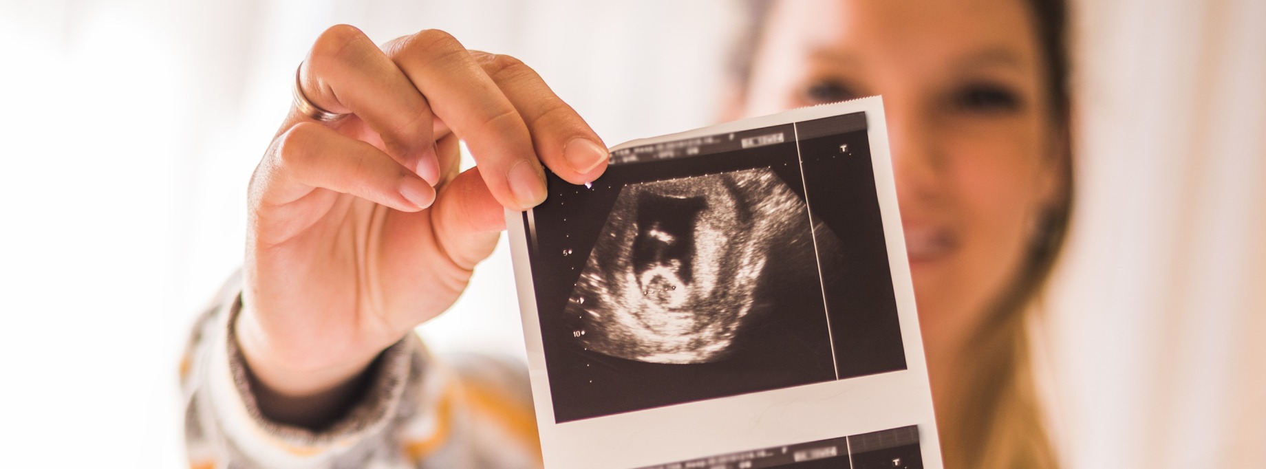 woman holding ultrasound photo
